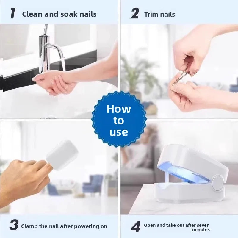 Aparelho de luz para limpeza de fungos nas unhas
