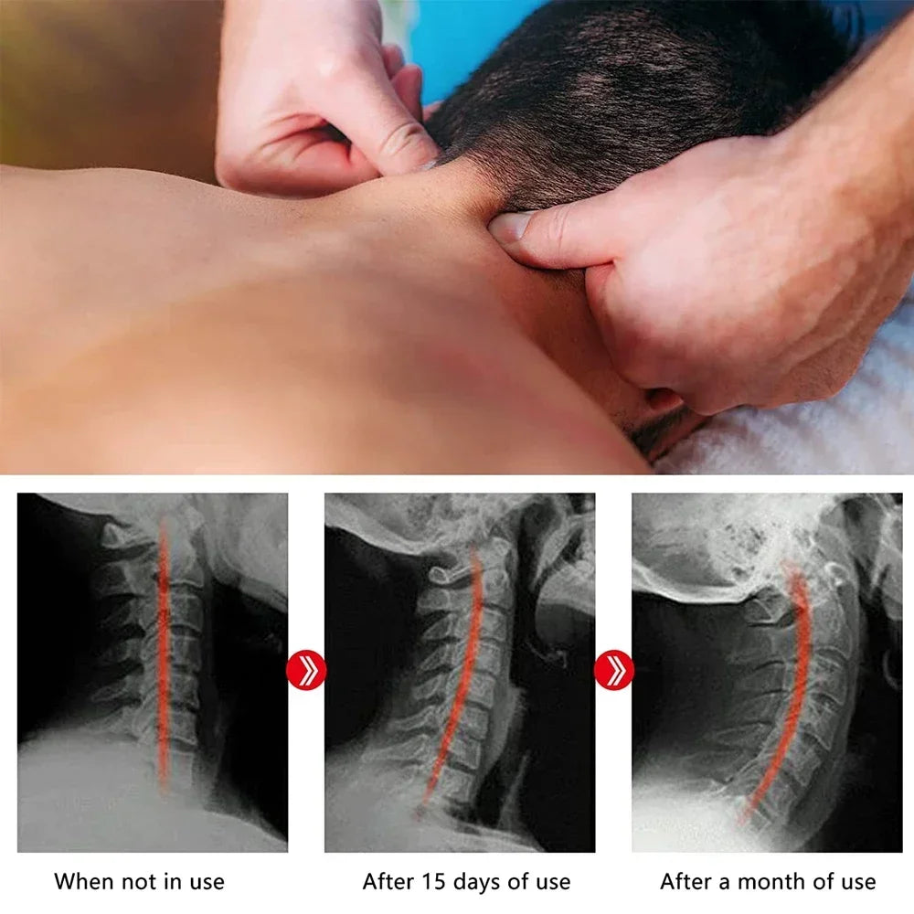 Alongador Cervical Ergonómico com Pontos de Massagem | Alívio da Tensão no Pescoço, Ombros e Coluna Cervical