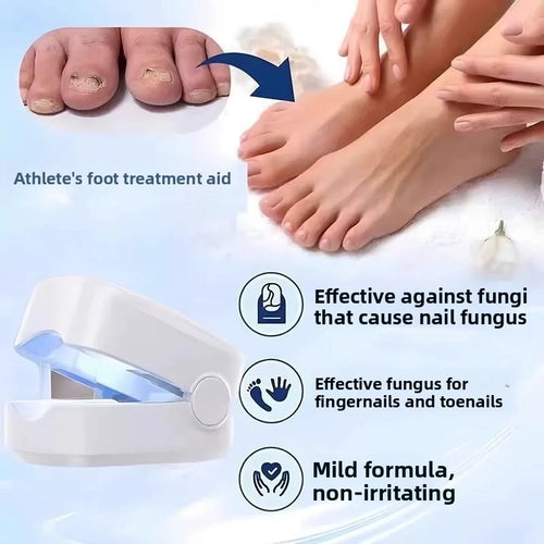 Aparelho de luz para limpeza de fungos nas unhas
