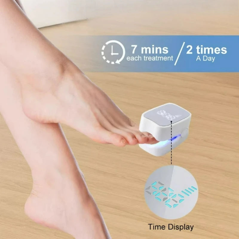 Aparelho de luz para limpeza de fungos nas unhas
